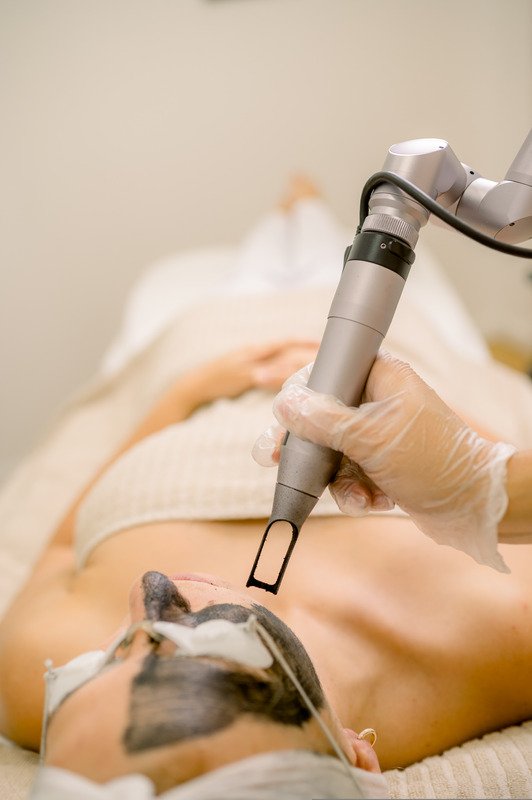 Laser Hair Removal 